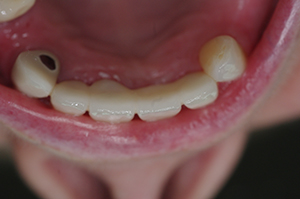 orthodontic treatment Salisbury